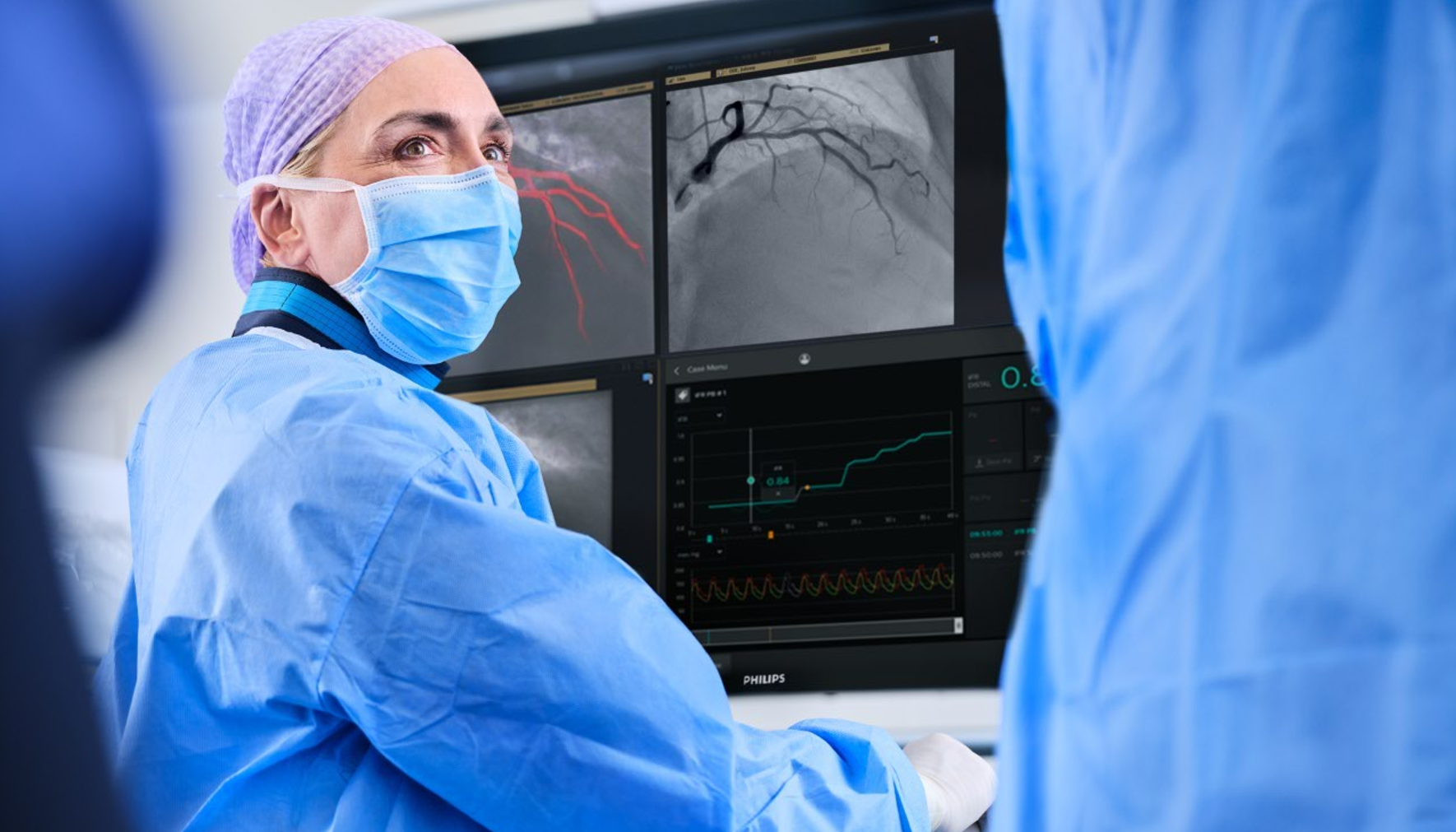 Philips_Inovatie in cardiologie